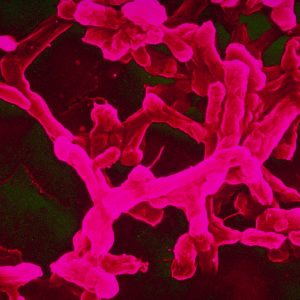 5279772517_d5b81fba0e_b 5279772517_d5b81fba0e_b