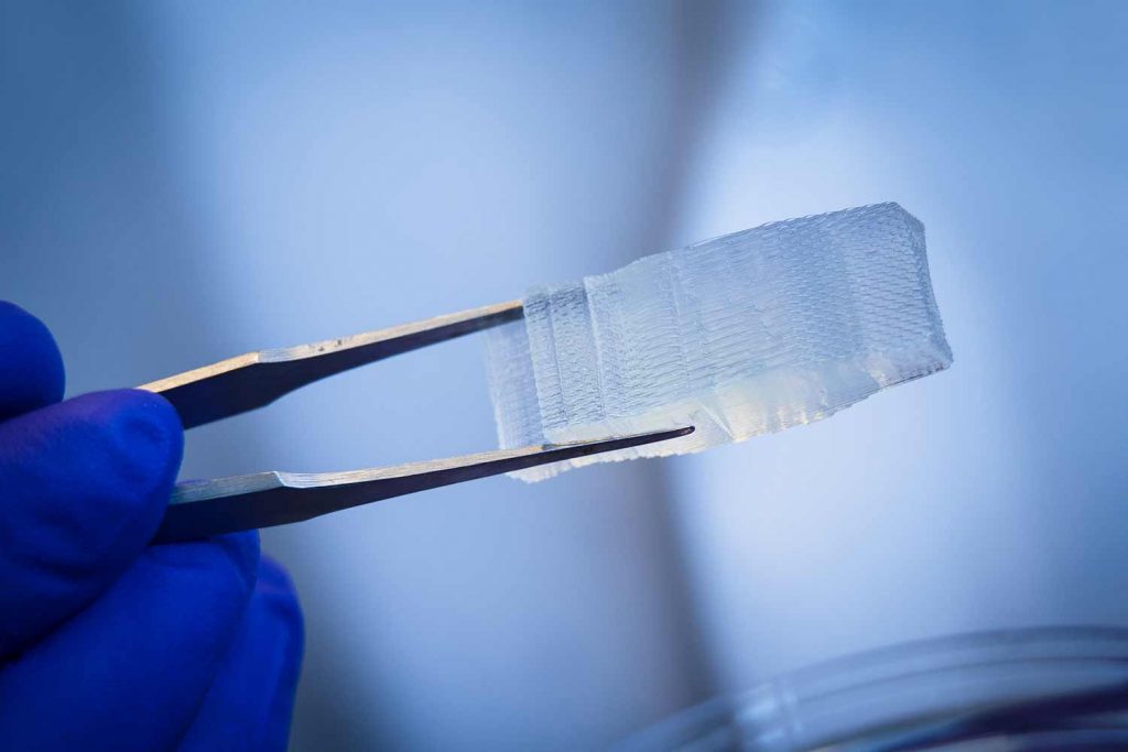 3D printed hydrogel implant